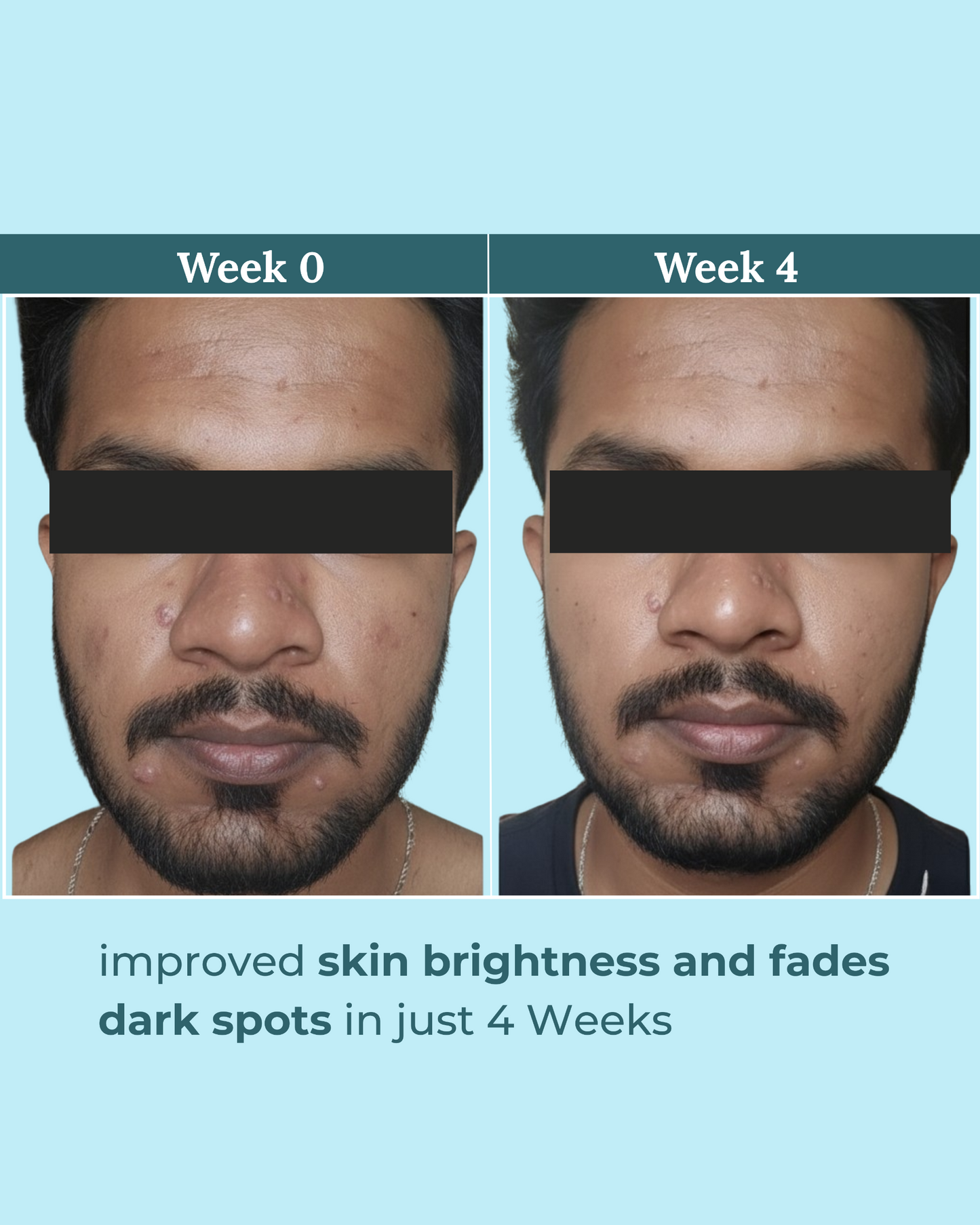 Berry Bliss Brightening Serum | 2% Alpha Arbutin and 5% Niacinamide