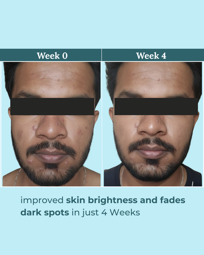 Berry Bliss Brightening Serum | 2% Alpha Arbutin and 5% Niacinamide