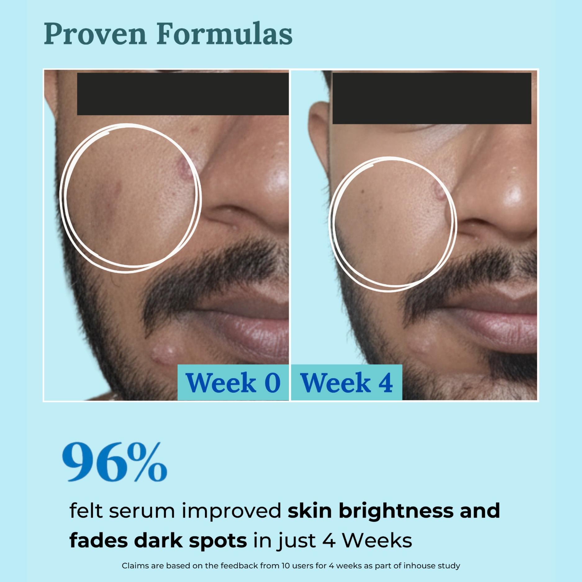 Berry Bliss Brightening Serum | 2% Alpha Arbutin and 5% Niacinamide