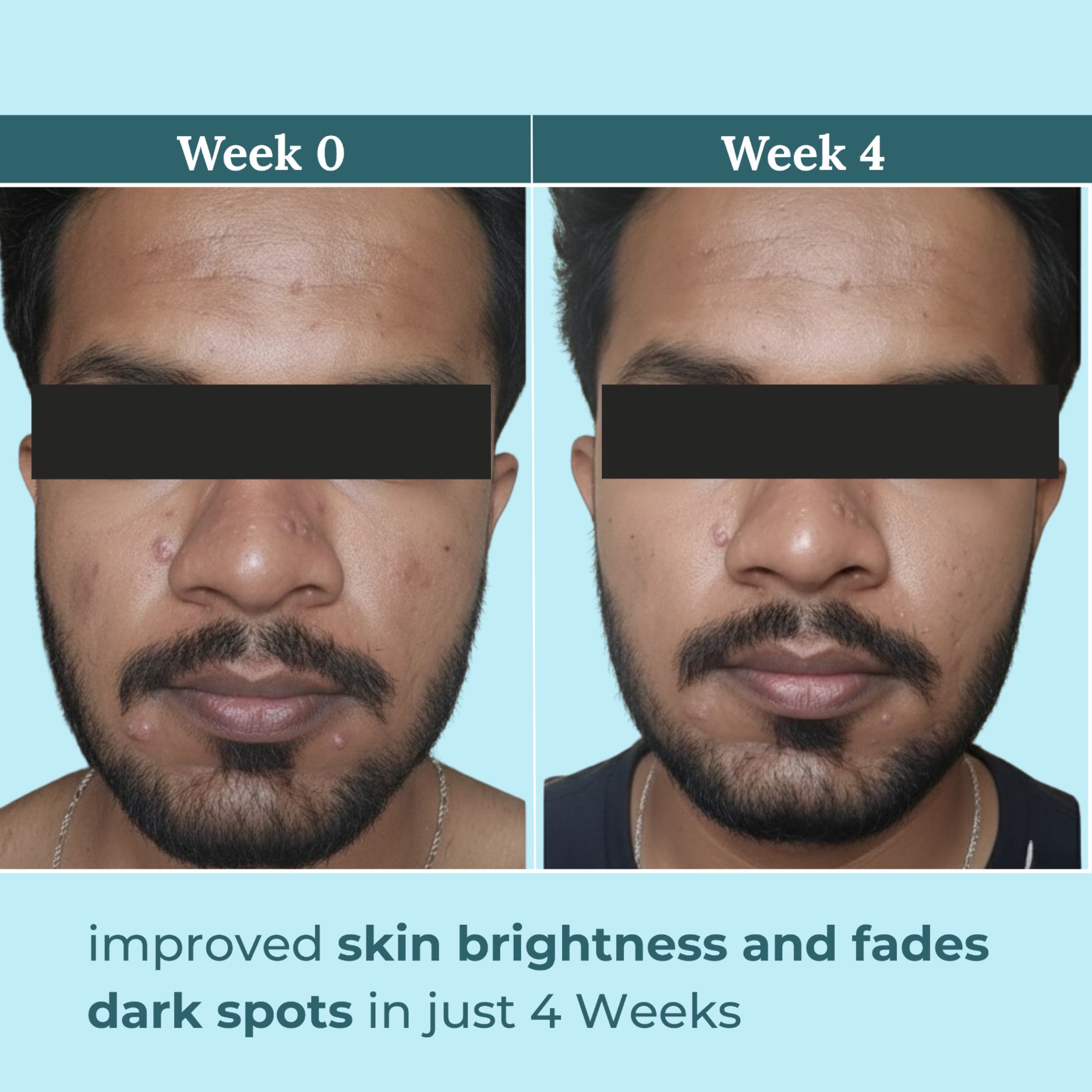 Berry Bliss Brightening Serum | 2% Alpha Arbutin and 5% Niacinamide