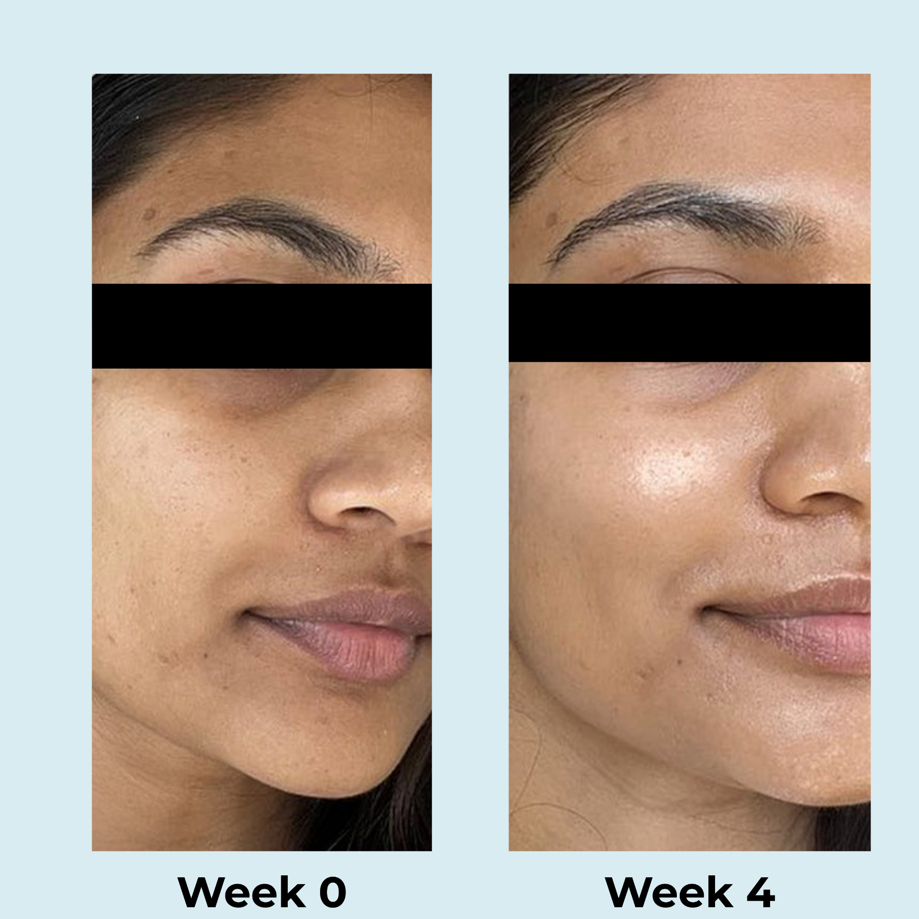 Berry Bliss Brightening Serum | 2% Alpha Arbutin and 5% Niacinamide