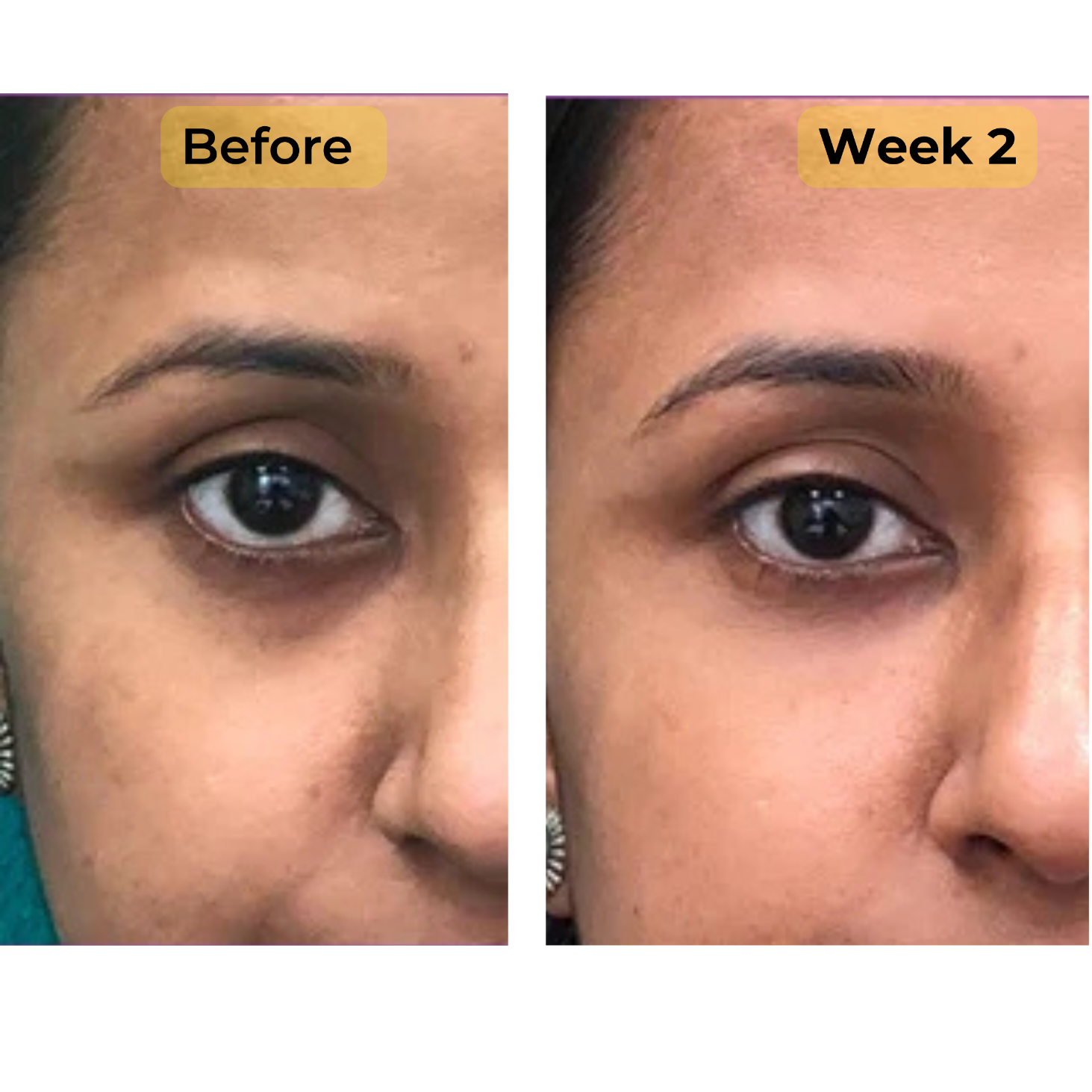 Pomegranate+Peptide Under Eye Cream (Controls Dark Circles)