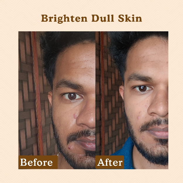 Berry Bliss Brightening Serum | 2% Alpha Arbutin and 5% Niacinamide